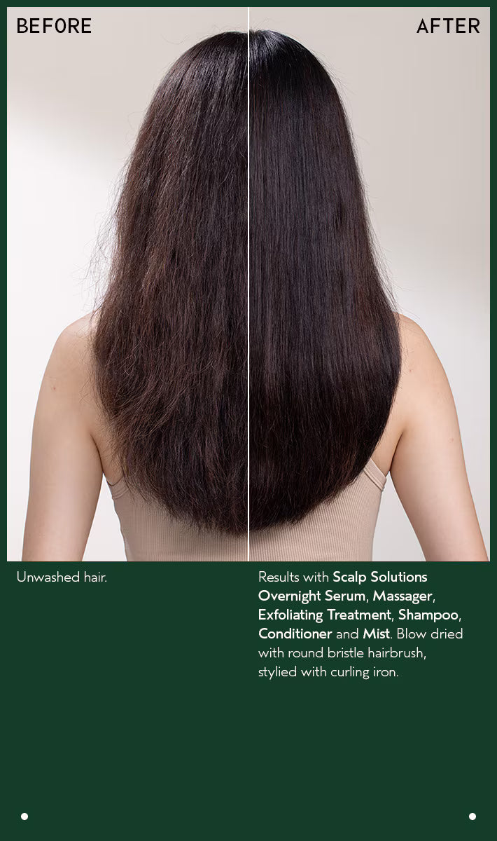 Scalp Solutions Stimulating Scalp Massager